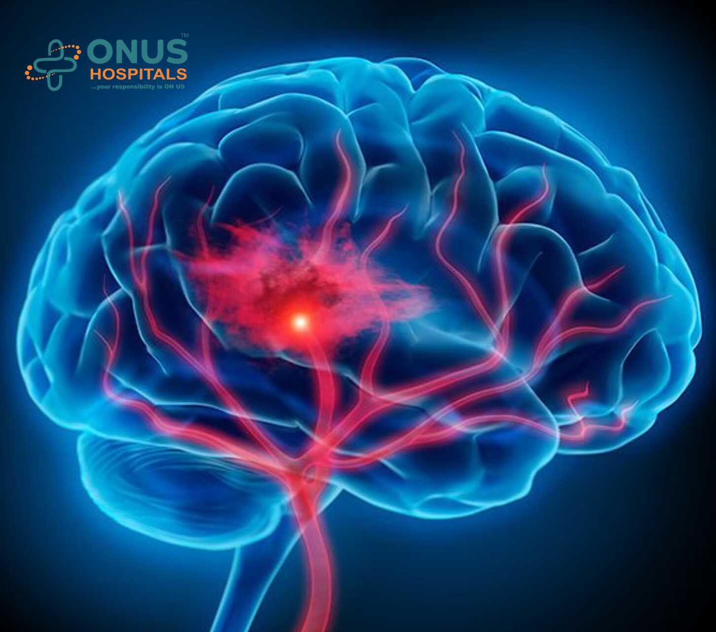 The Benefits of Neurosurgery: An Overview of Its Many Uses 